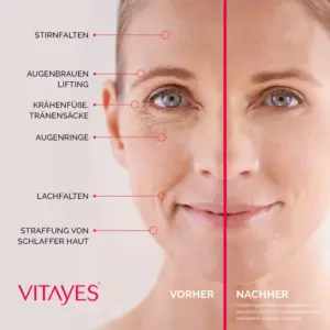 vitayes instant ageback lifting cream